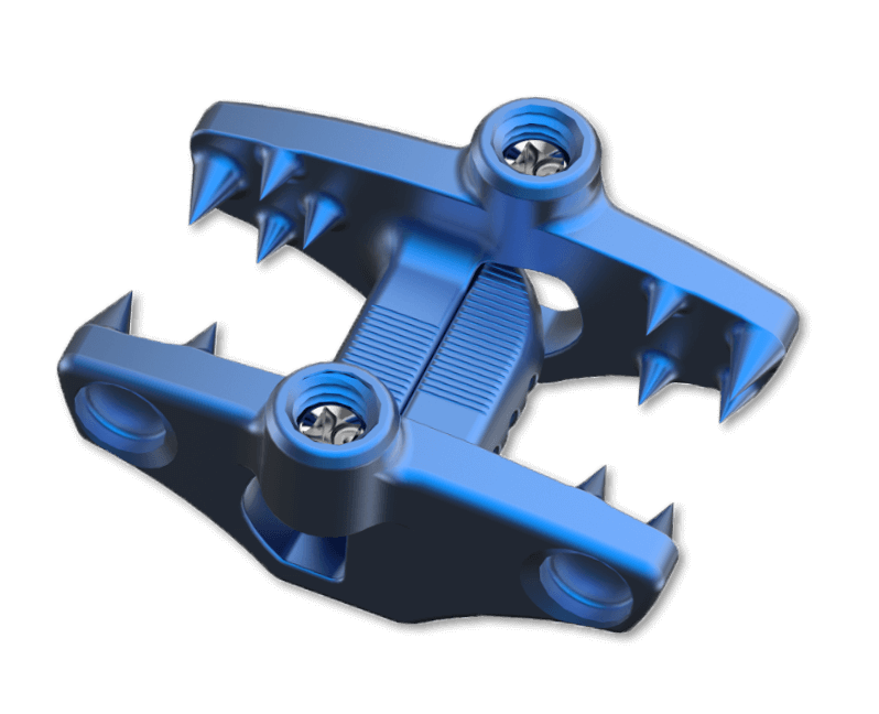 Inspan ScrewLES interspinous fixation system